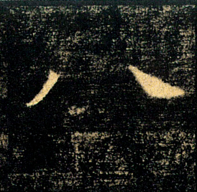 �������ϸ����